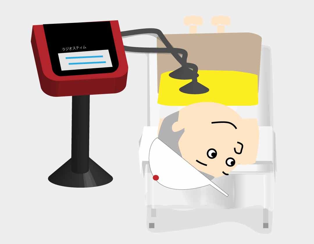 ラジオスティム
